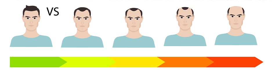 WHAT IS THE BEST TIME TO PERFORM A HAIR TRANSPLANT IN TURKEY? WHAT IS THE BEST TIME TO PERFORM A HAIR TRANSPLANT IN TURKEY?