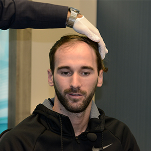 IMPLANT DE CHEVEUX