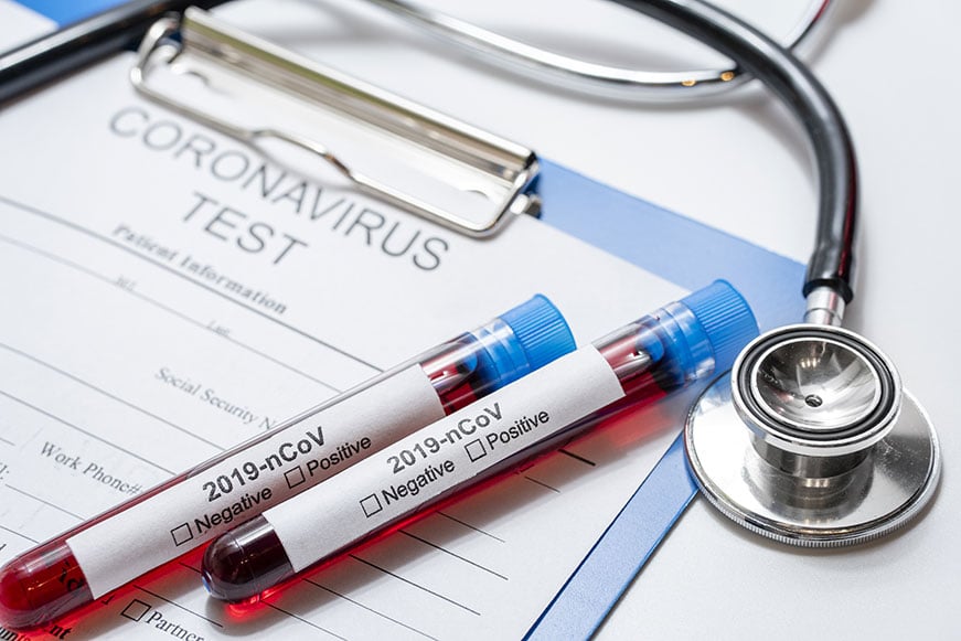 Är coronavirus och alopeci relaterade till varandra?