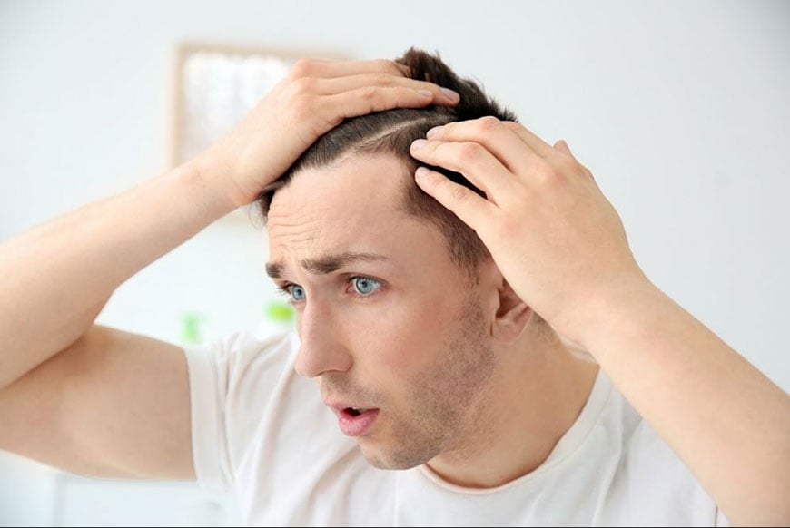Ist Haarausfall durch Hypothyreose reversibel?