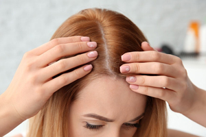 الحالات التي لا ينصح فيها اجراء عملية زراعة الشعر