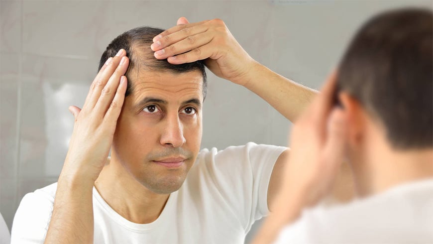 Chute de cheveux saisonnière: quand et pourquoi cette chute se produit-elle?