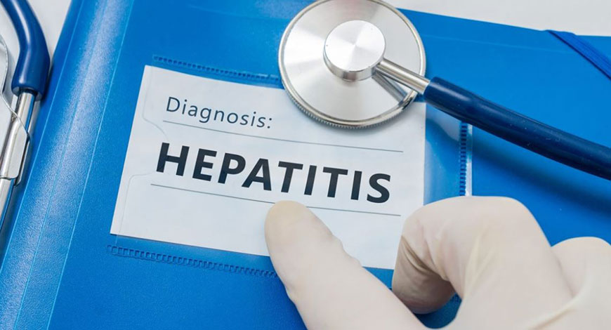 ¿Puedo realizar un trasplante capilar si tengo hepatitis C?